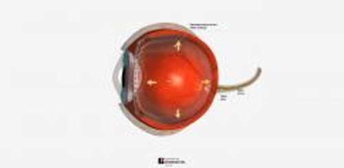 biodigital-glaucoma-cv-sized