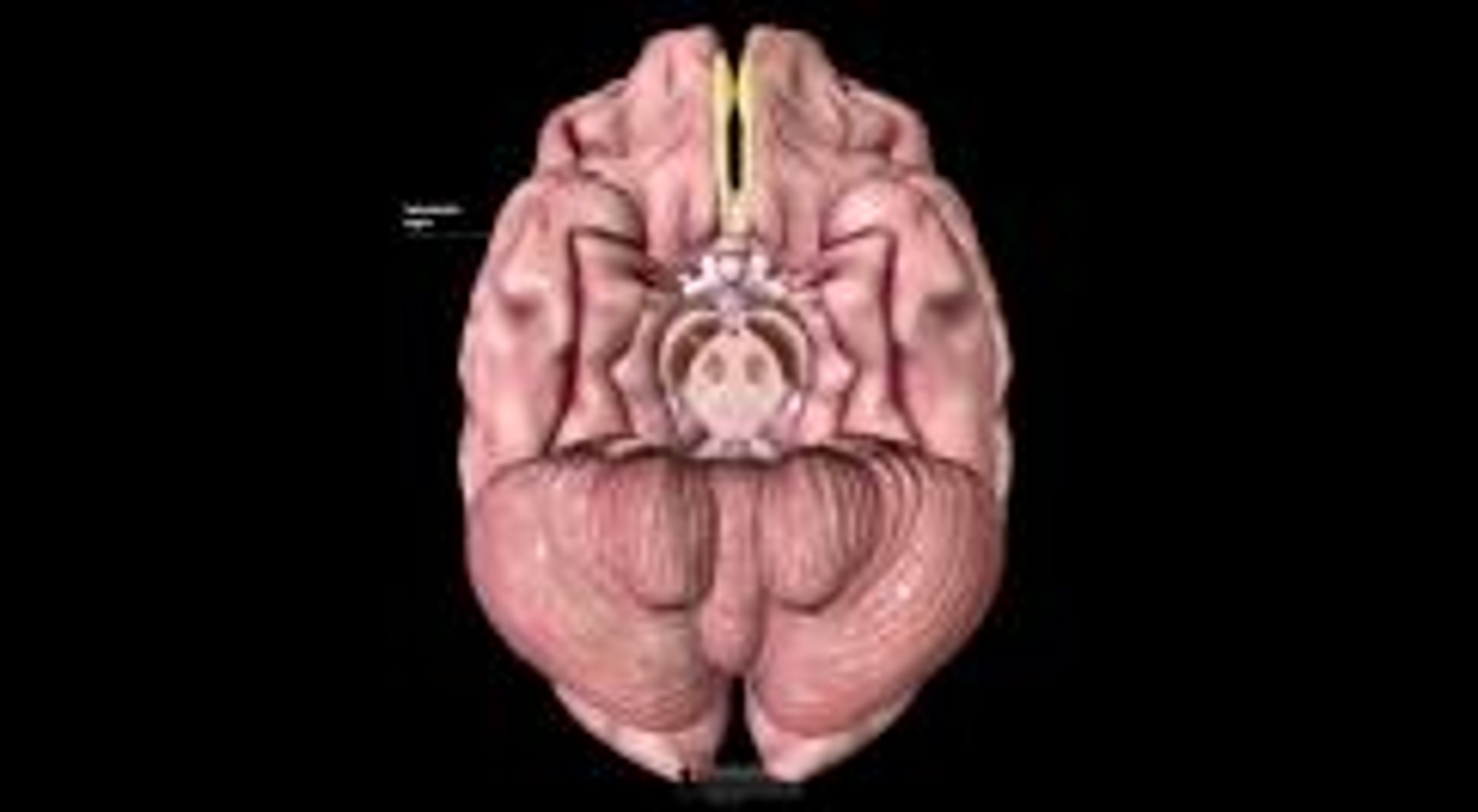 Midbrain Segment 3D Model: Midbrain: Cross-Section (Normal Anatomy)-Merck Manual ...