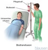 Bluttransfusion