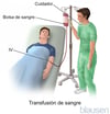 Transfusión de sangre