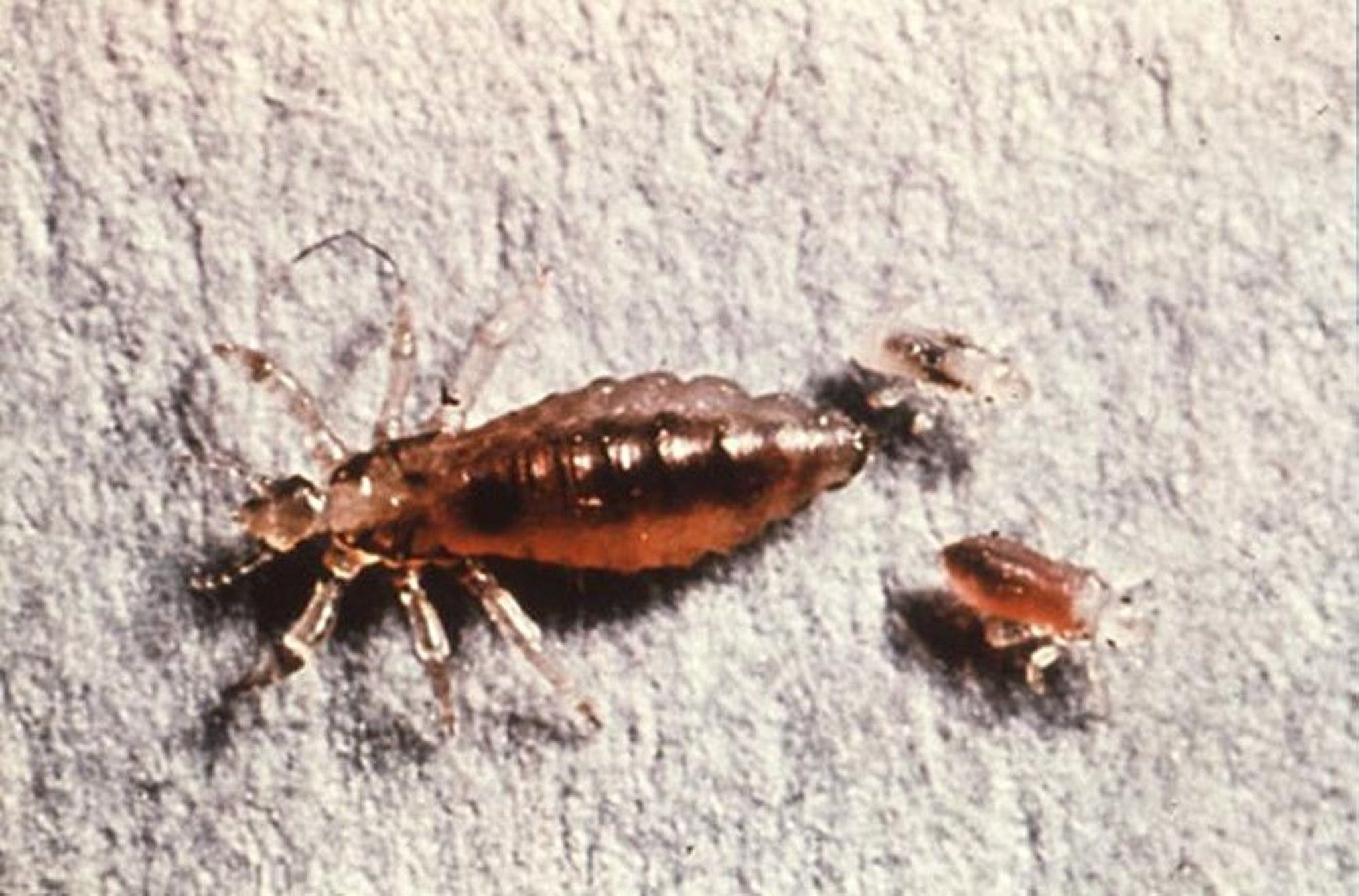 Lice That Transmit Relapsing Fever