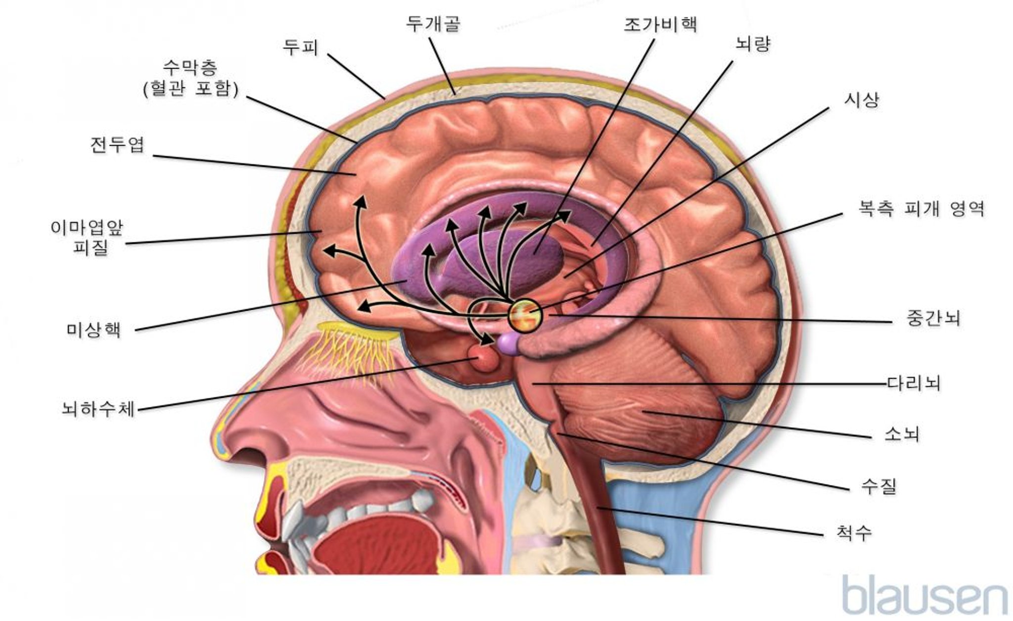 뇌 내부(속질모세포종)