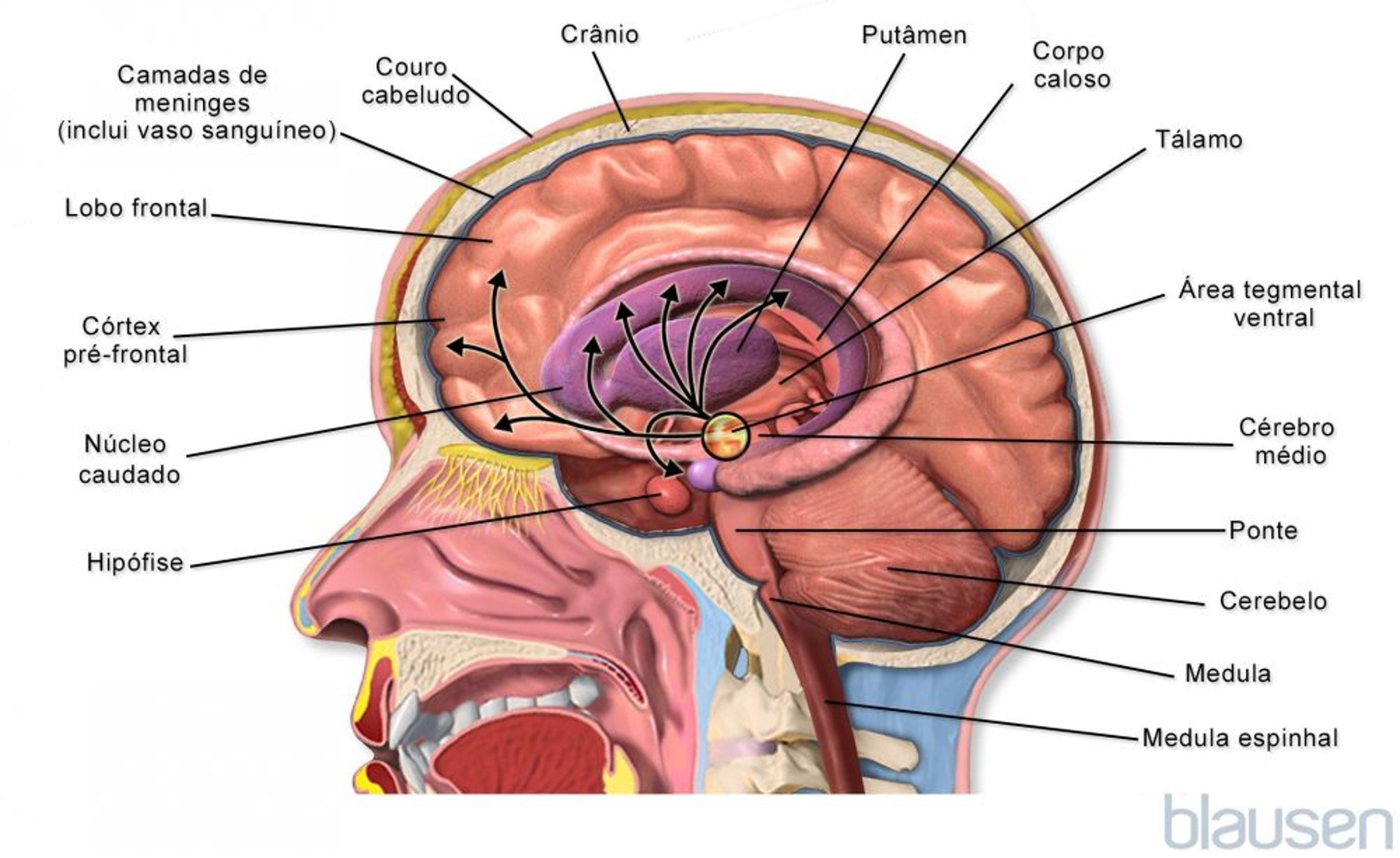 Dentro do cérebro (meduloblastoma)