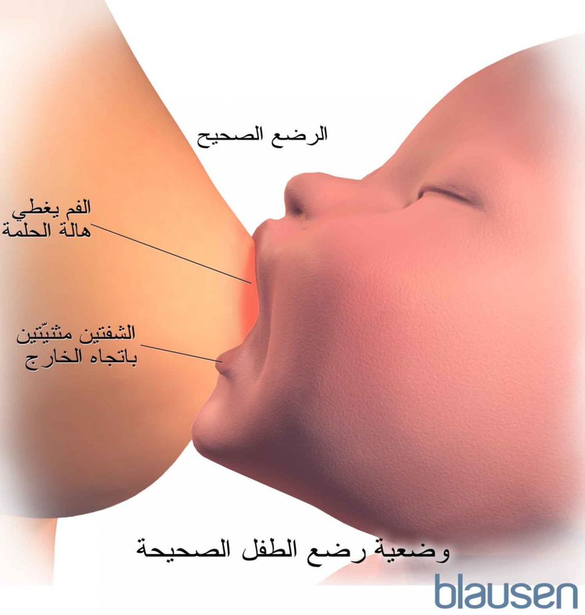 وضعية الالتقاط الصحيحة للرضاعة الطبيعية