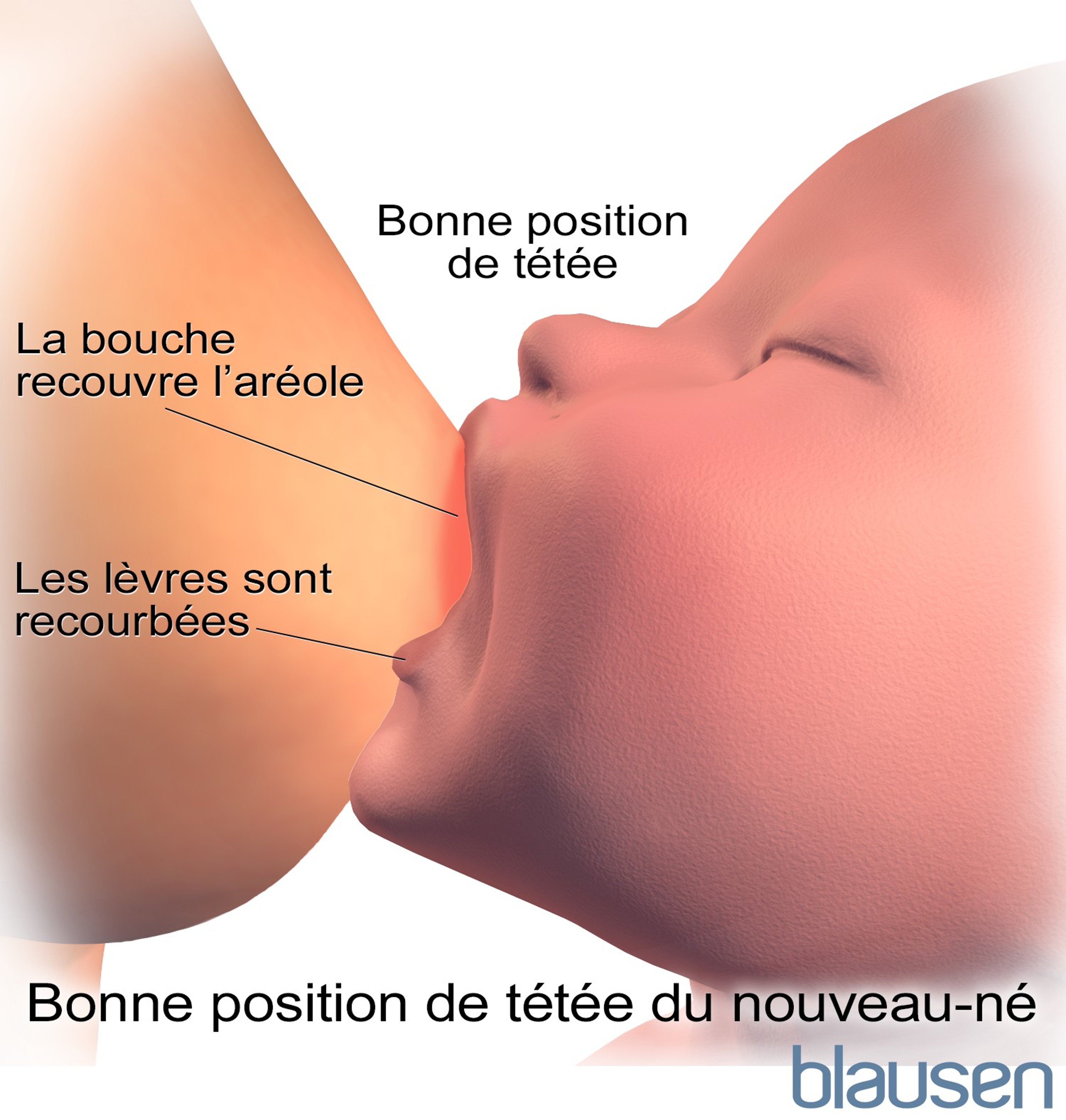 Bonne position au sein pour l’allaitement