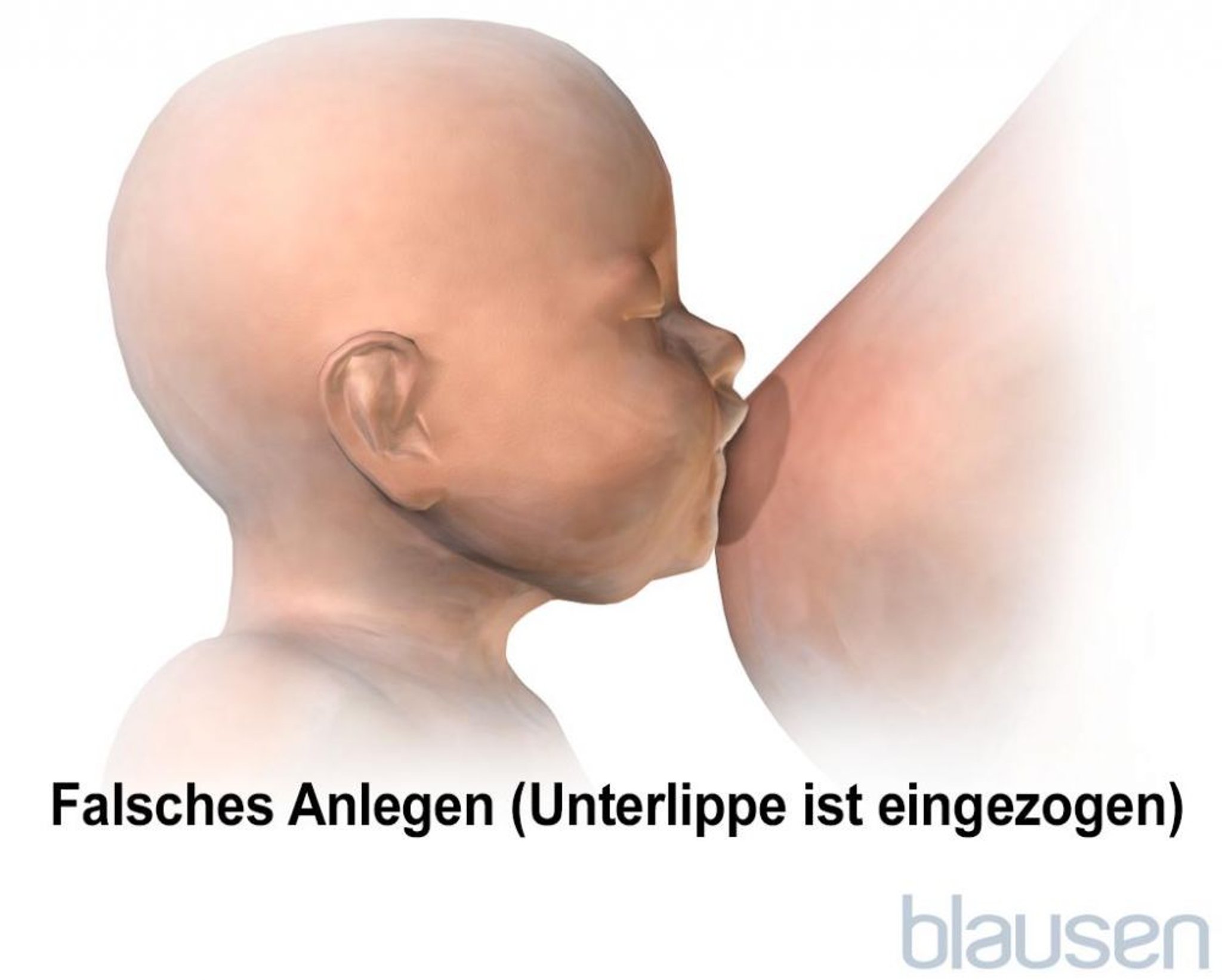 Falsche Position, um das Baby beim Stillen an die Brust anzulegen