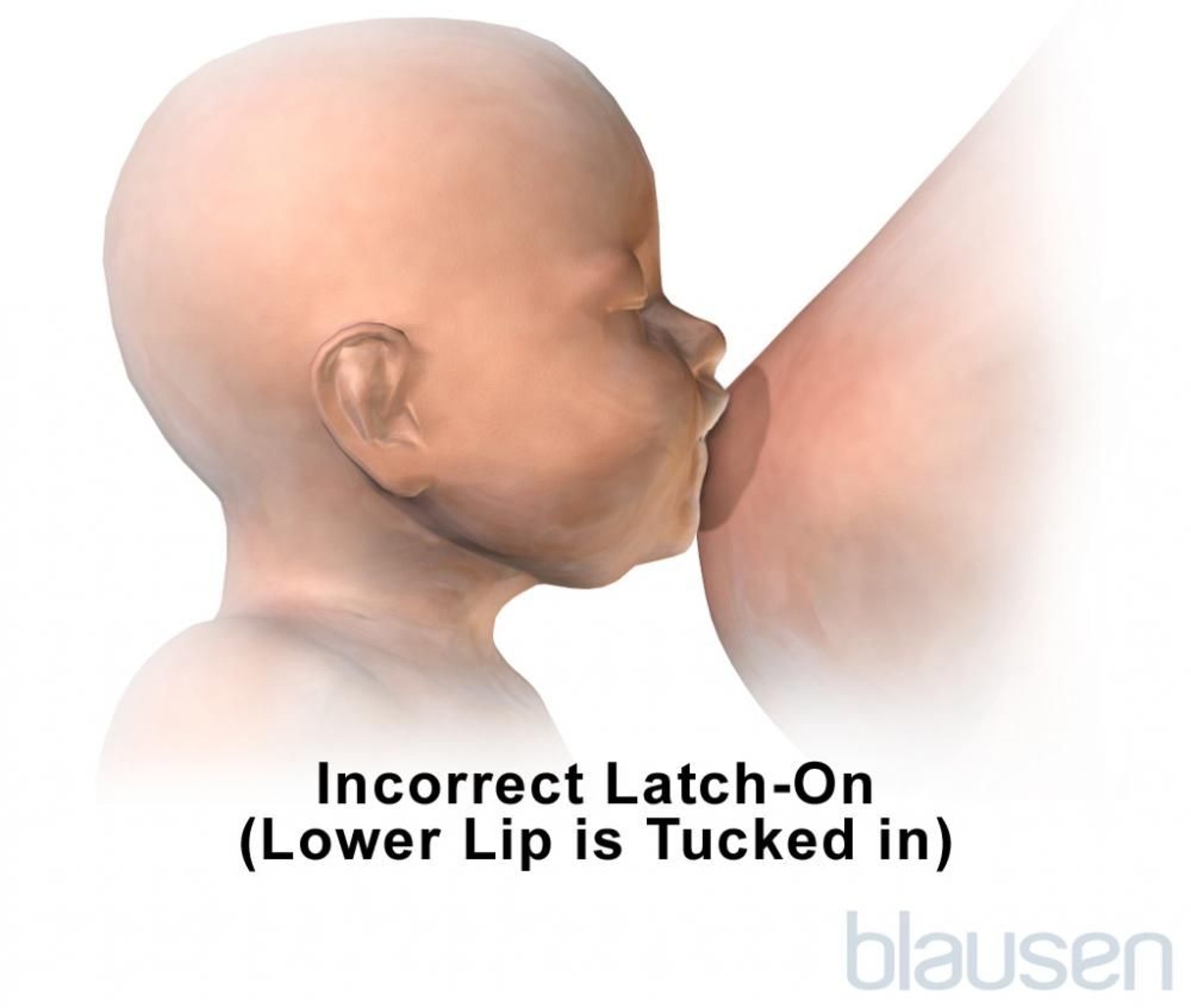 母乳喂养的错误锁定位置