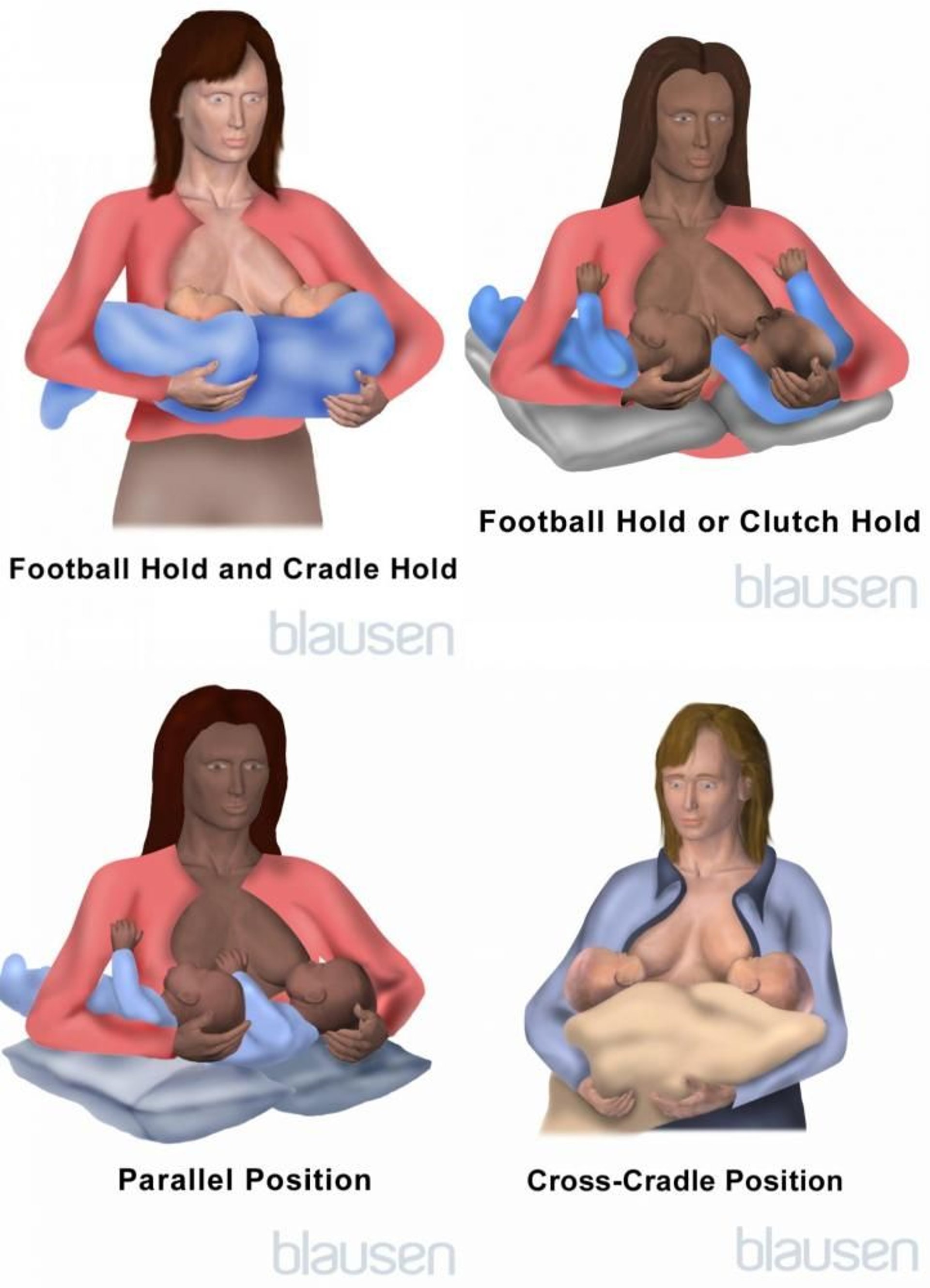 母乳喂养多个婴儿时的一些体位