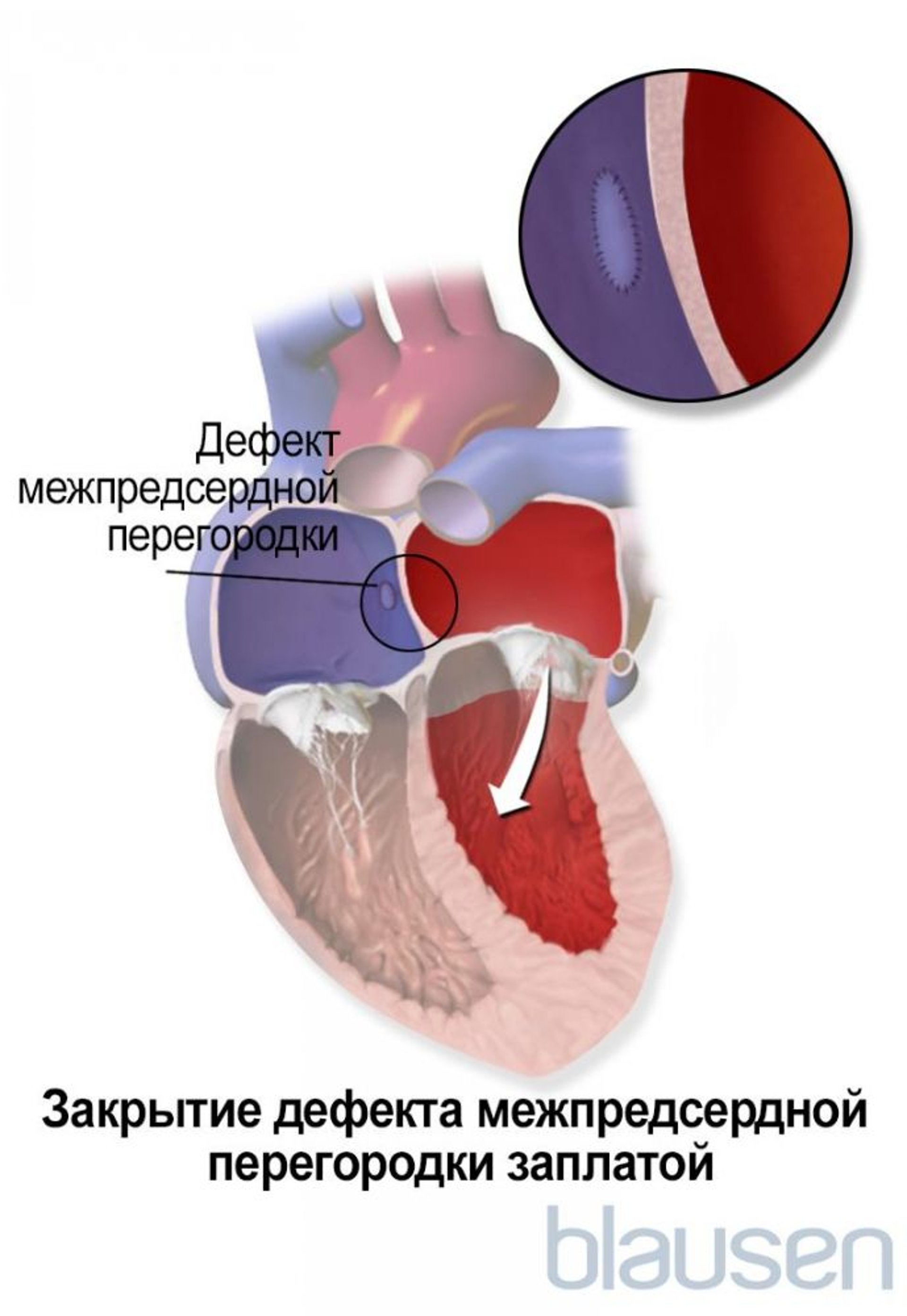 Положения во время сна при боли в спине