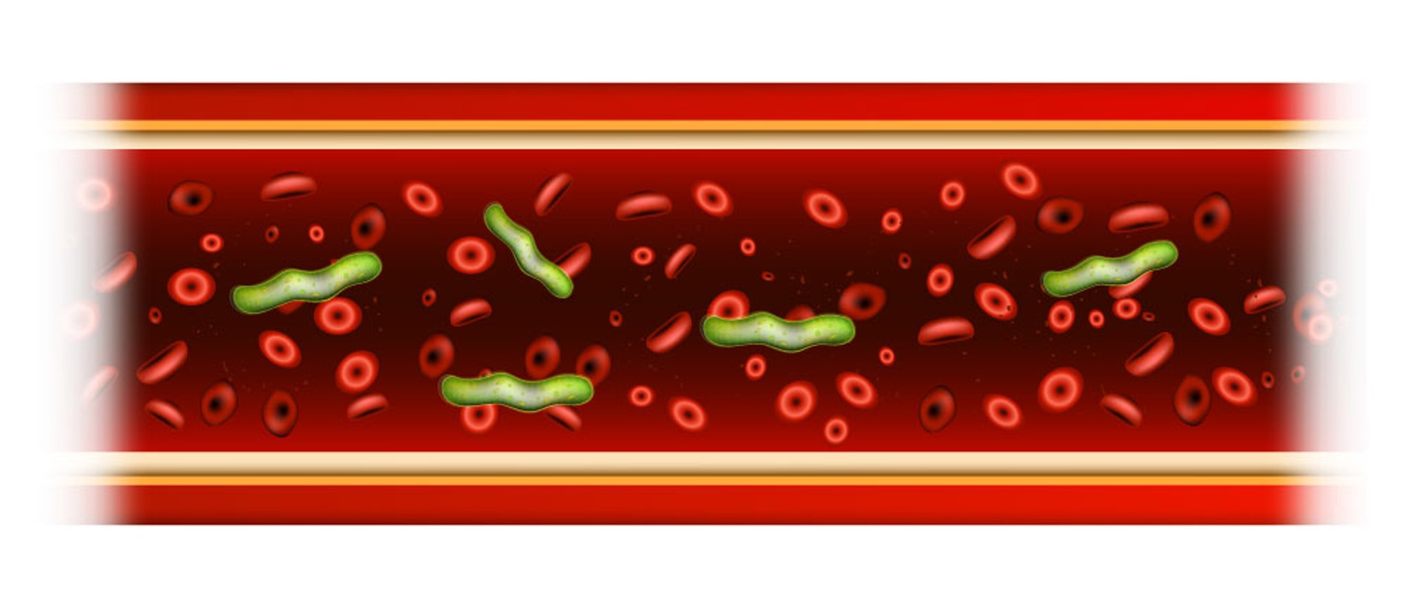 Bacteria in the Blood