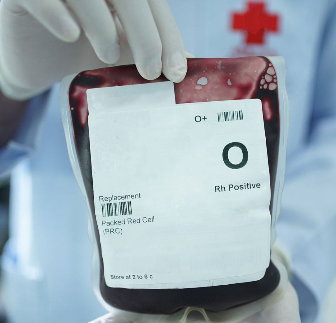 Packed Rbc Gif Image:Bag of Packed Red Blood Cells-MSD Manual Consumer Version
