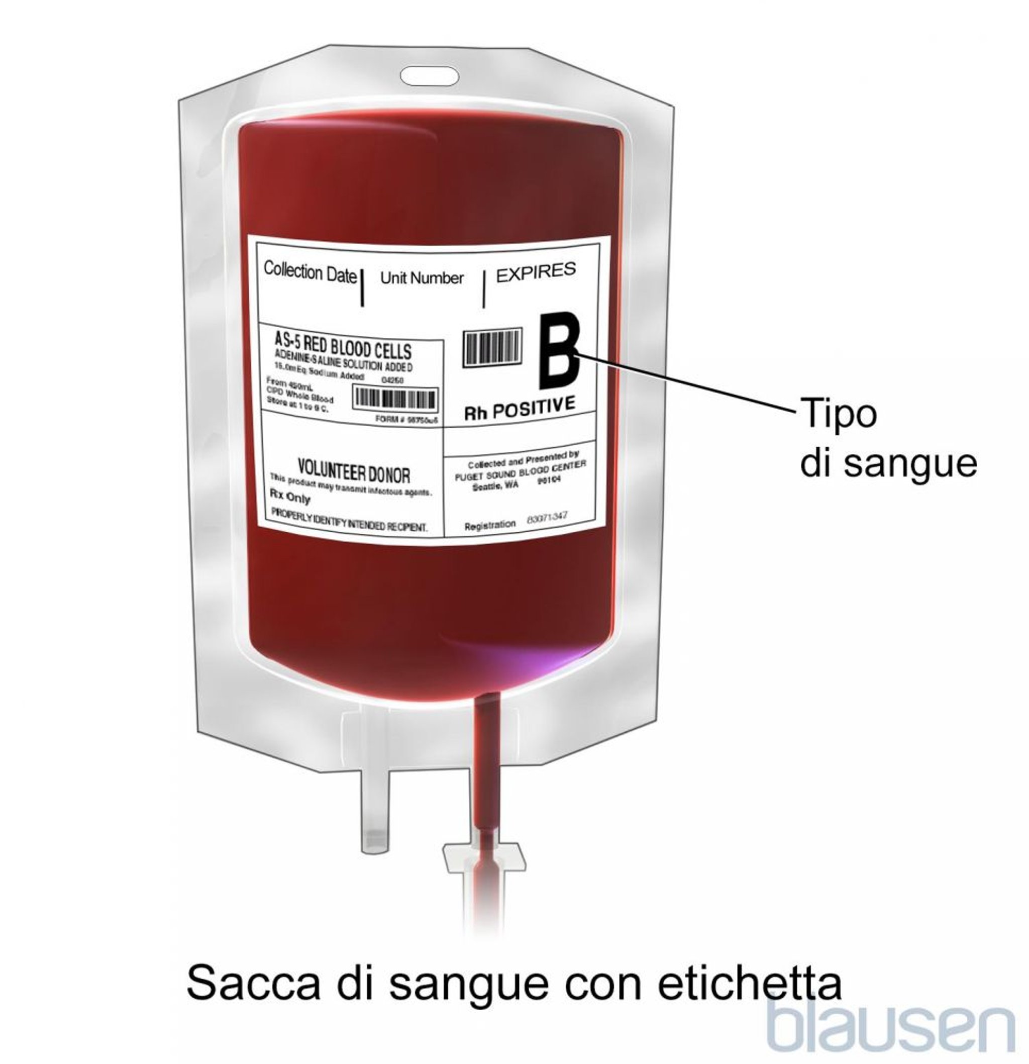 Sacca di sangue