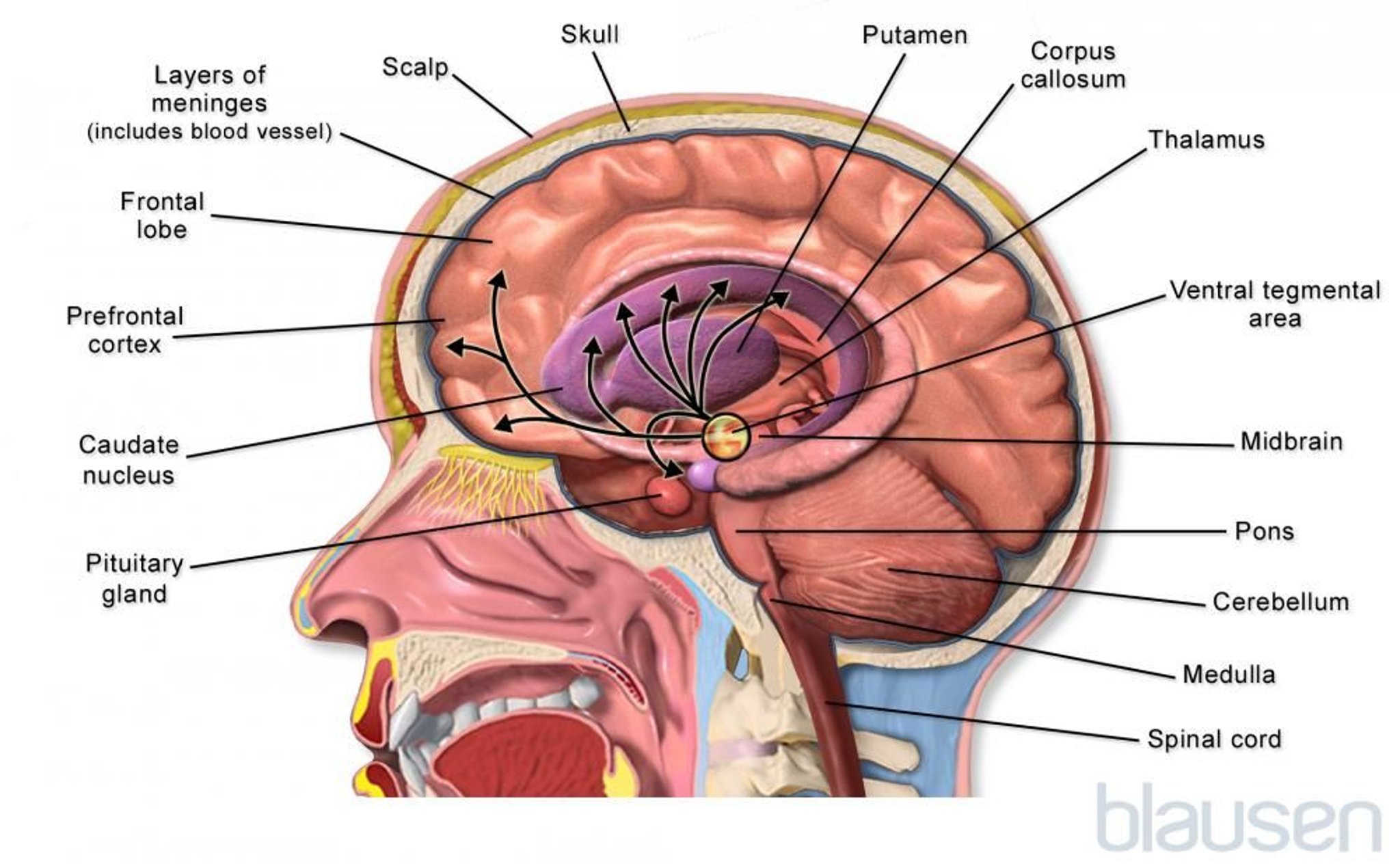 Dentro del cerebro (ependimoma)