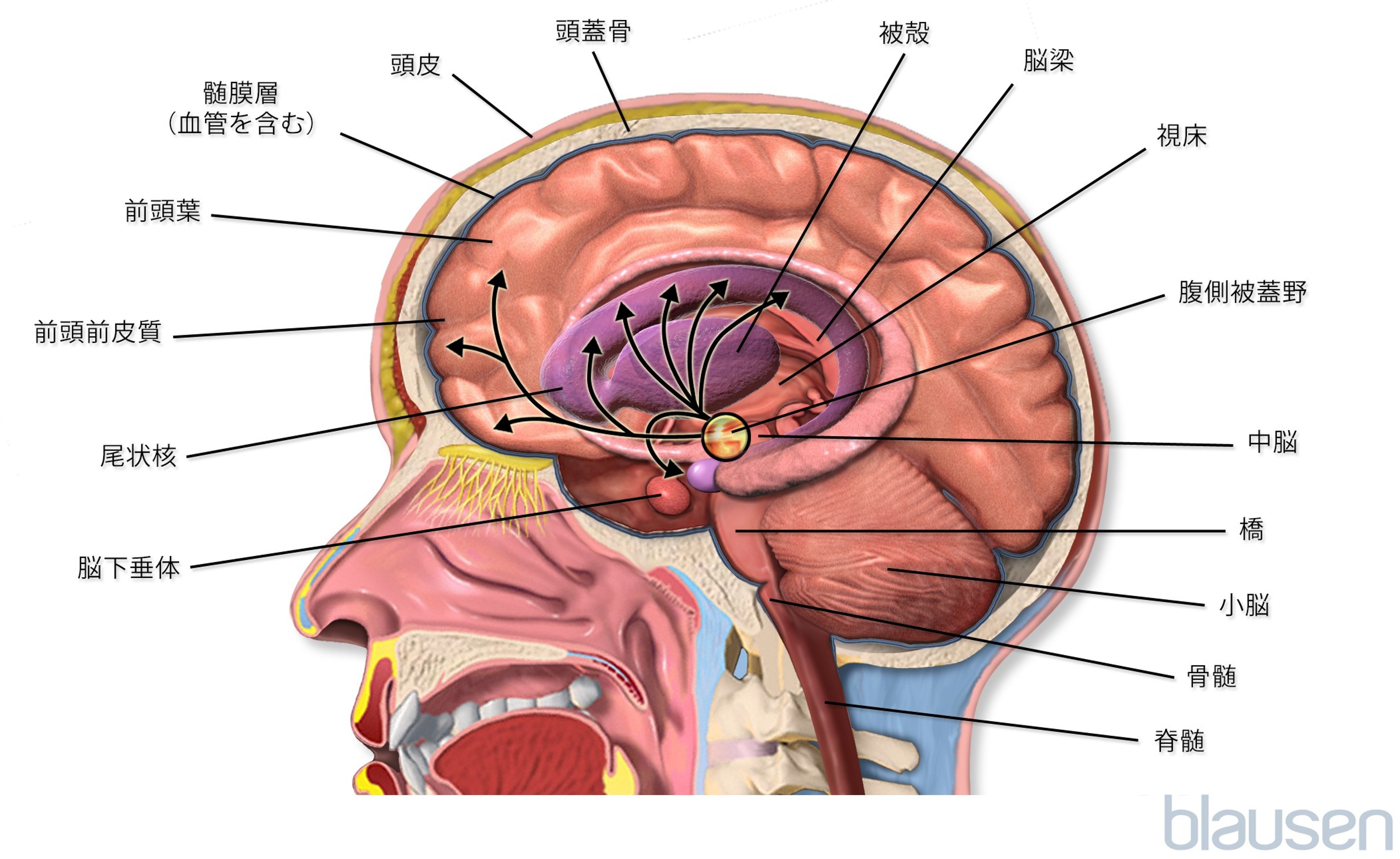 脳の内部（髄芽腫）