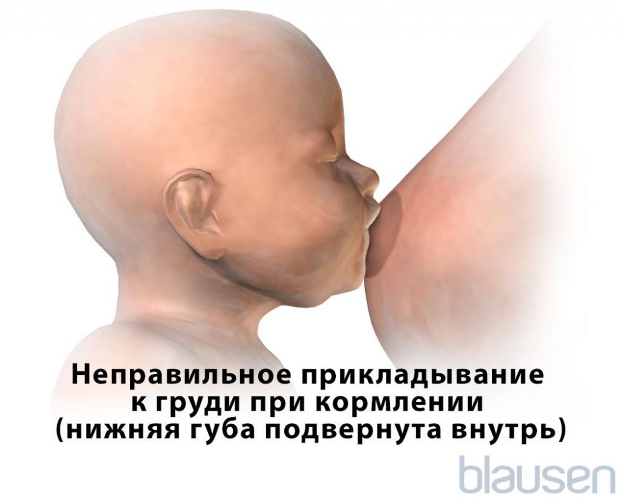 Неправильное положение прикладывания для грудного вскармливания