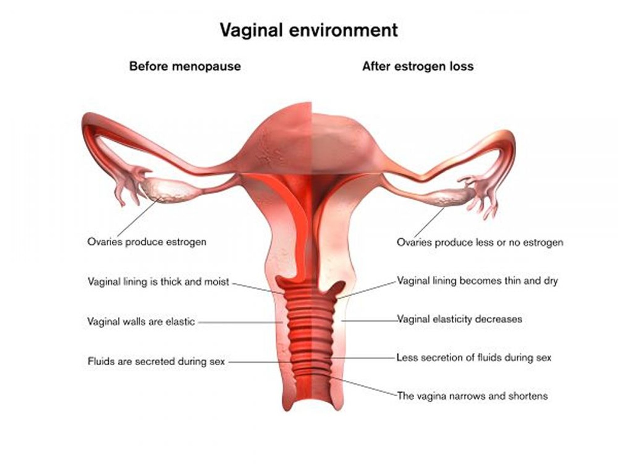 Effects of Menopause on the Vagina