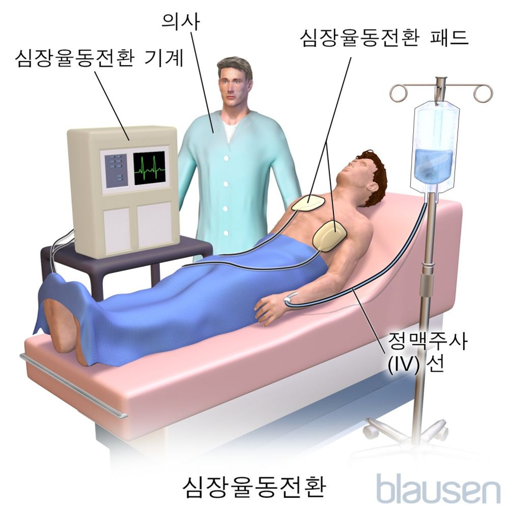 심장율동전환