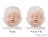 구순열 복원