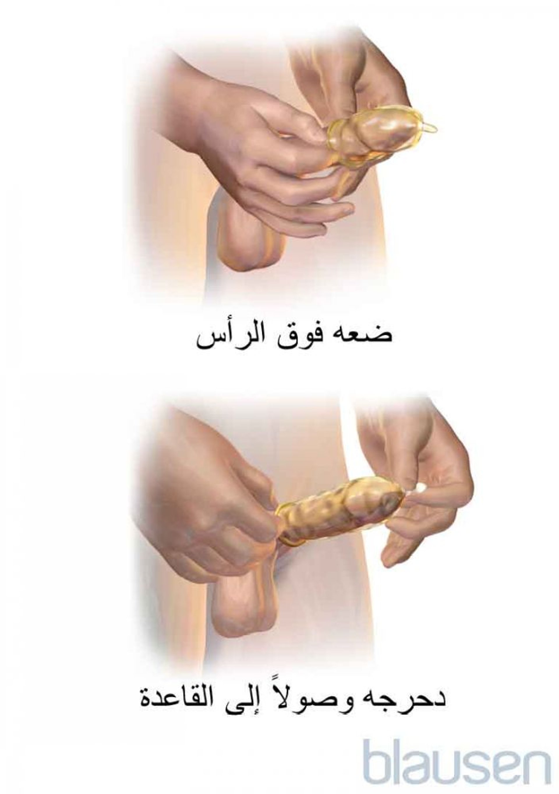 كيفية ارتداء الواقي الذكري الخارجي