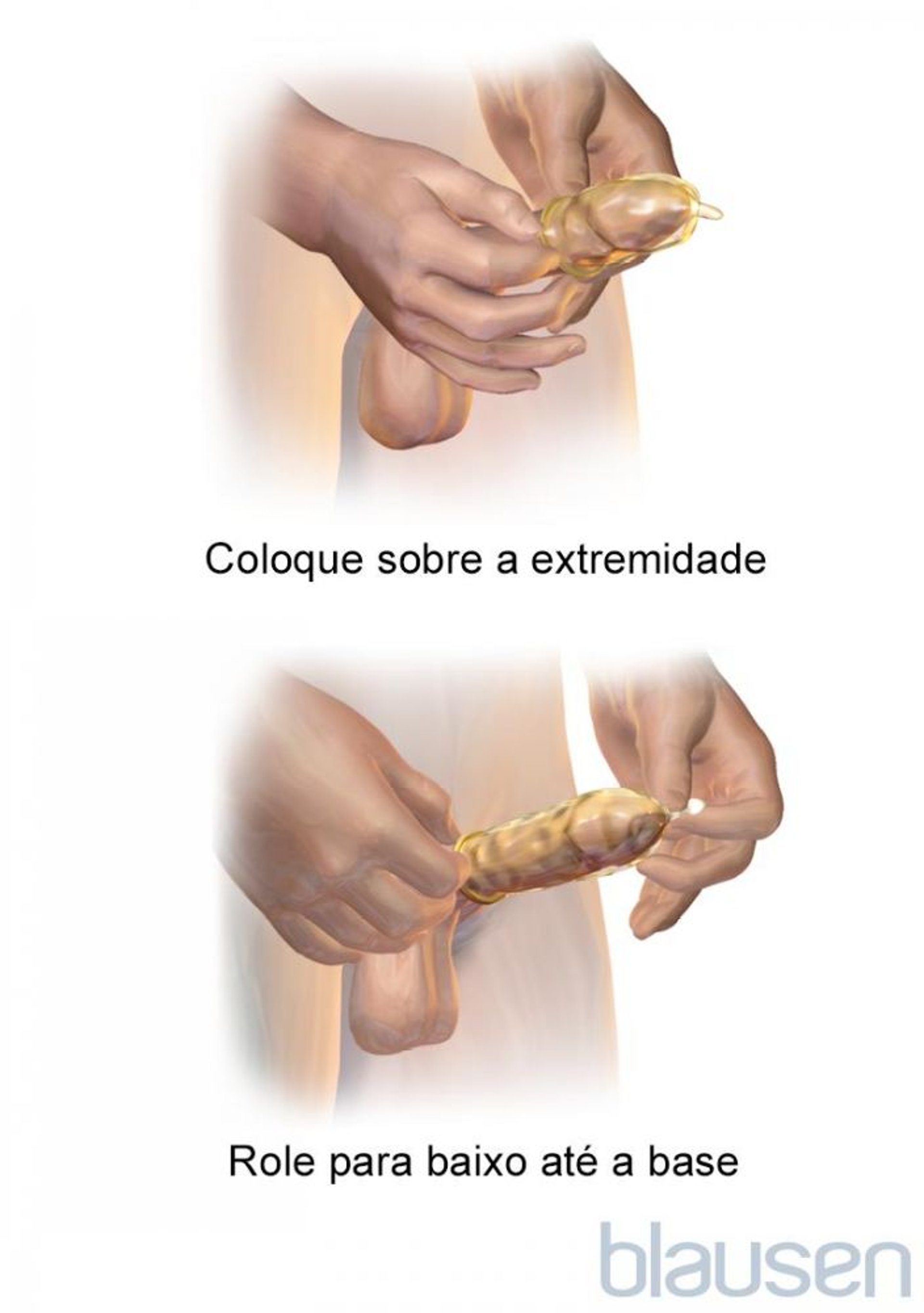 Como colocar um preservativo externo