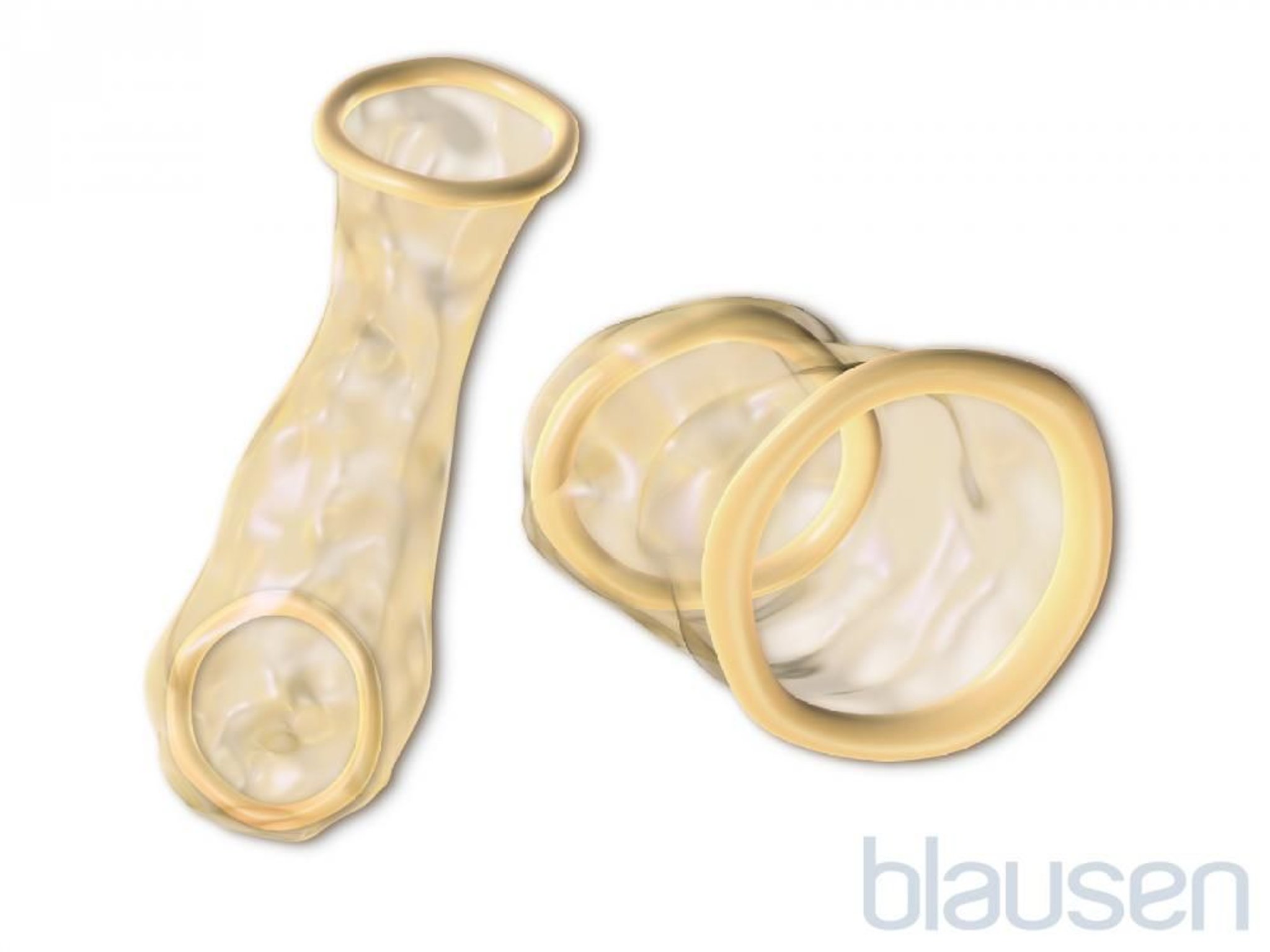 आंतरिक कंडोम