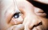 Conjunctivitis in a Newborn