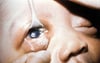 Conjuntivitis en un recién nacido
