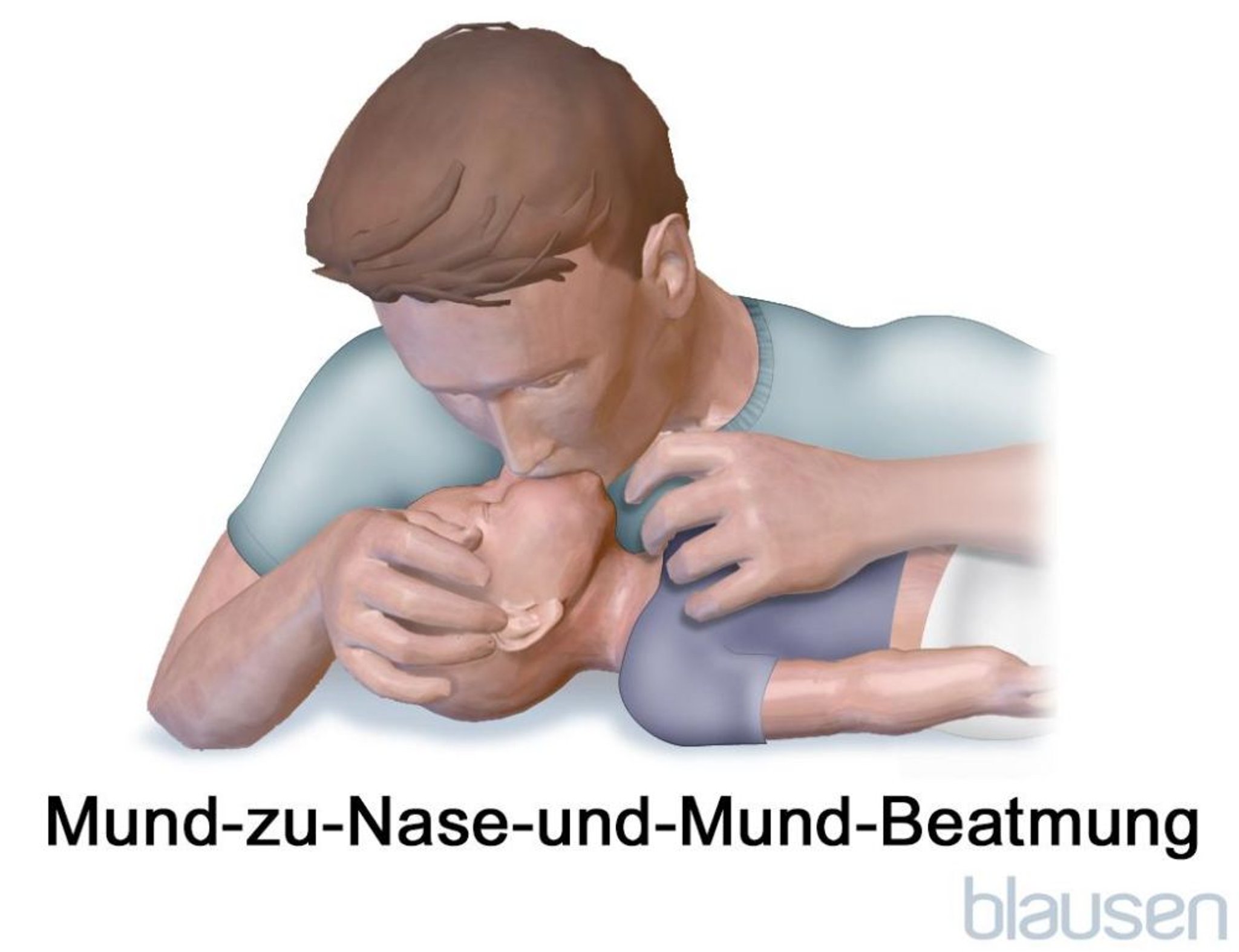 Mund-zu-Nase-und-Mund-Beatmung bei einem Säugling