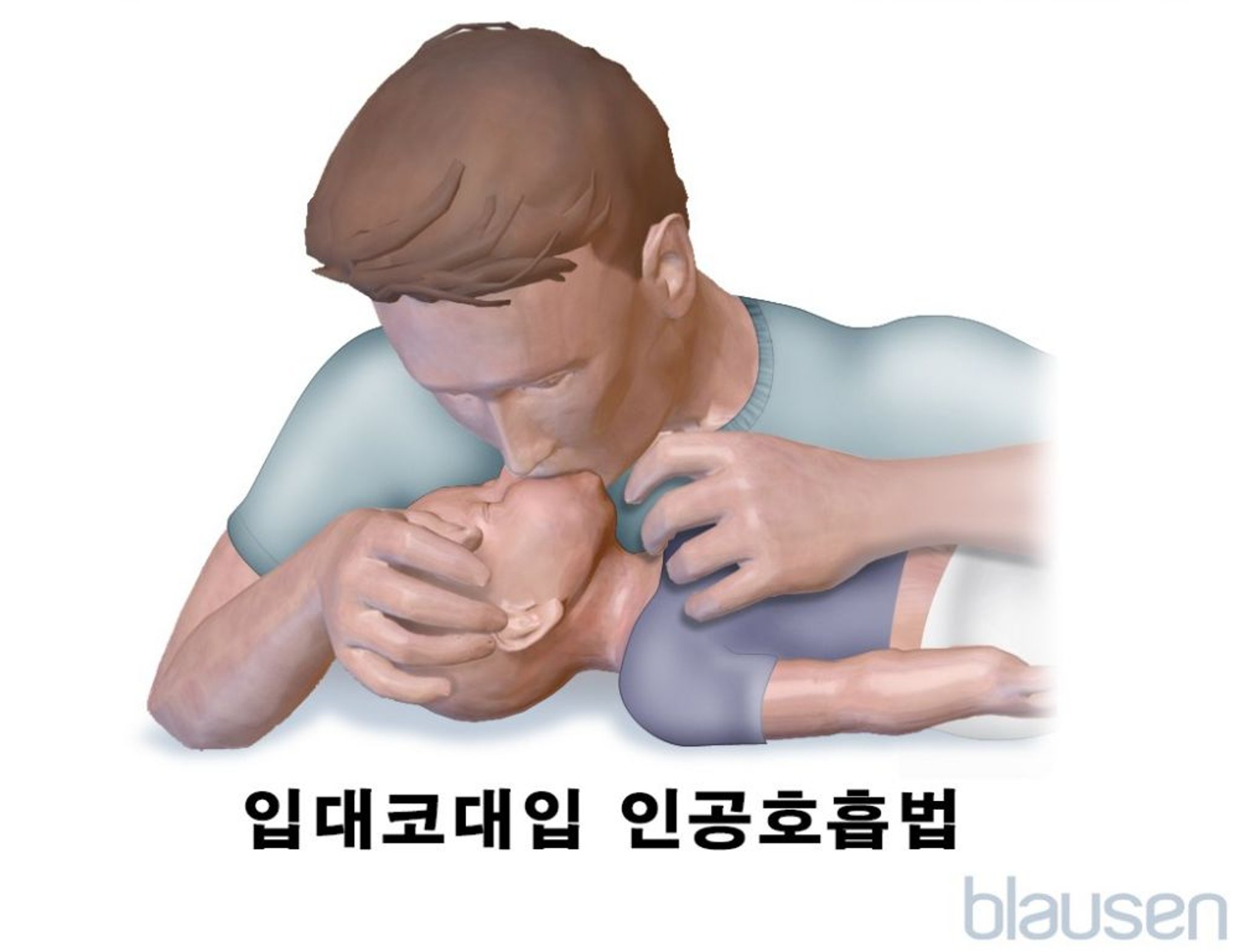영아의 입대코대입 인공호흡법