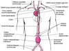 Où se produisent les anévrismes de l’aorte ?