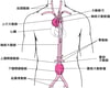 大動脈瘤が発生する場所