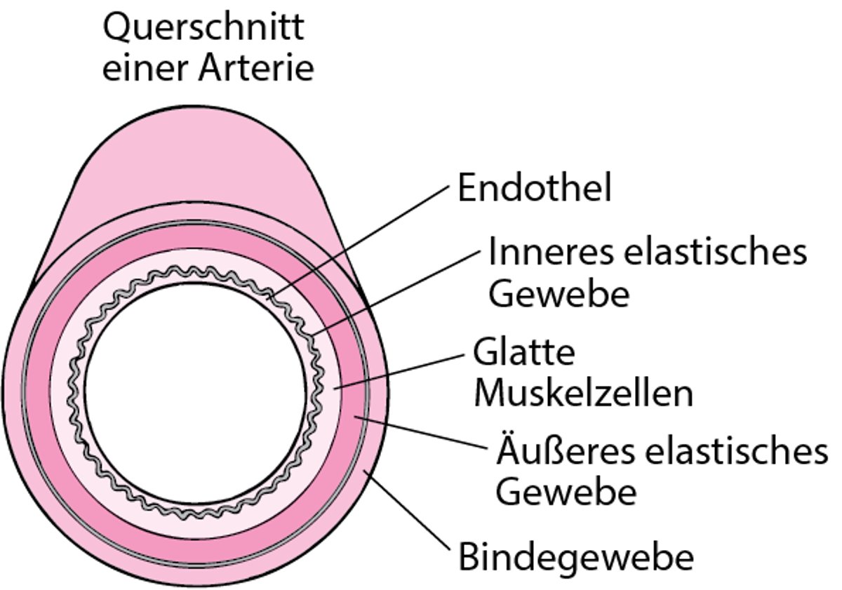 Wie Atherosklerose entsteht