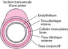 Comment l’athérosclérose se produit