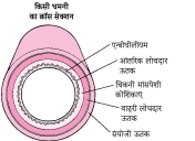 एथरोस्क्लेरोसिस कैसे विकसित होती है