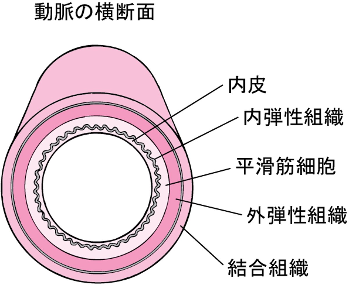 アテローム性動脈硬化が起こる過程