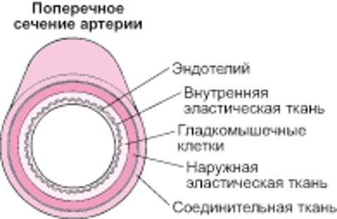 Как развивается атеросклероз