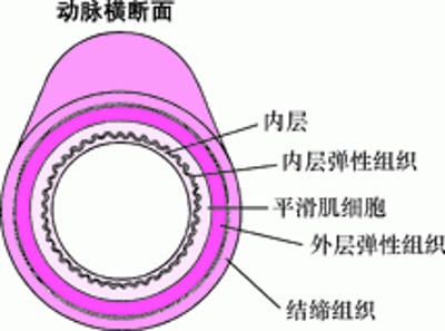 动脉粥样硬化如何形成