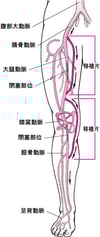 脚のバイパス手術