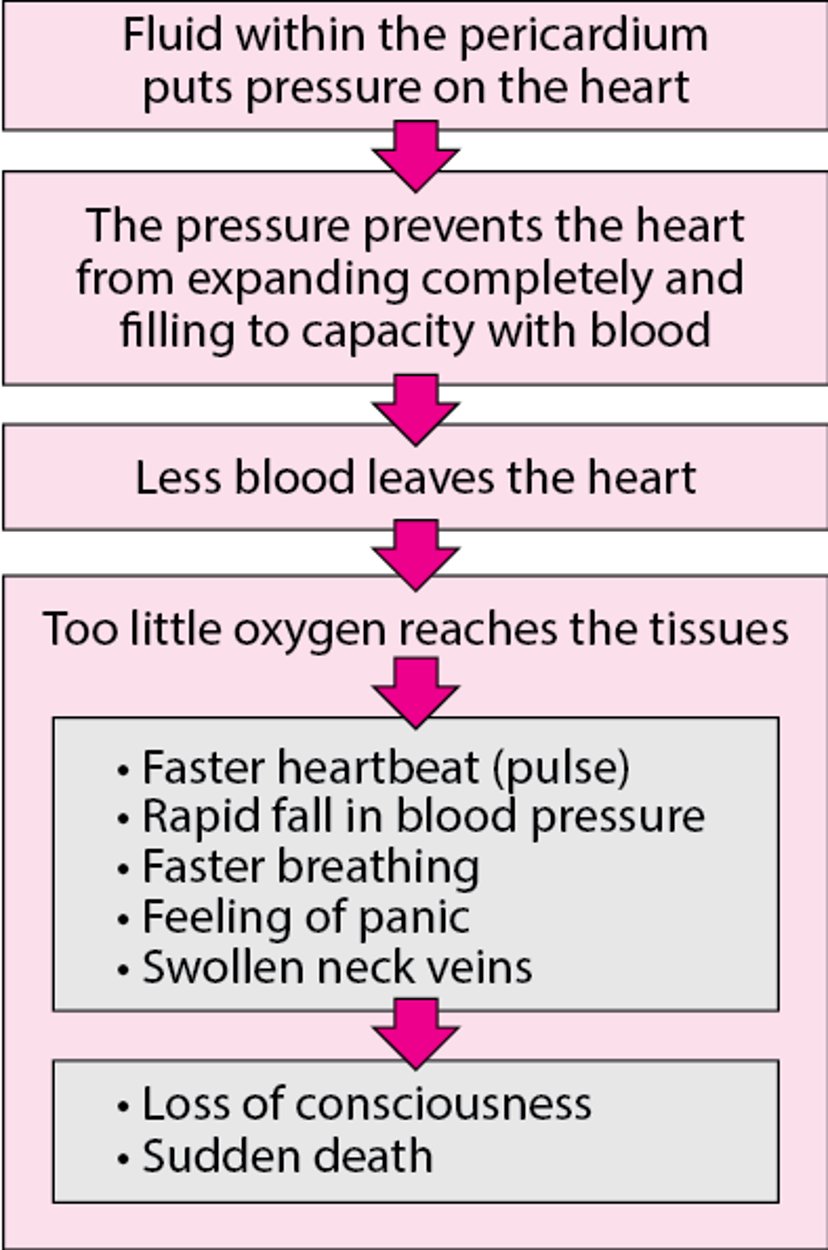 Cardiac Tamponade