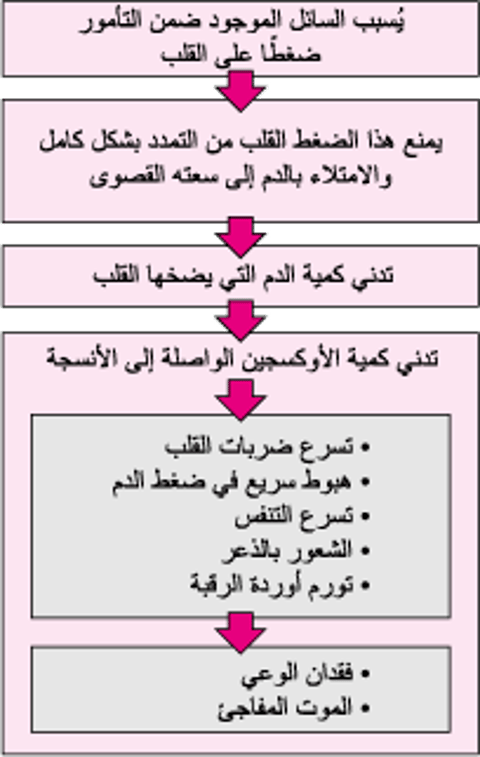 اندِحَاس القلب Cardiac Tamponade