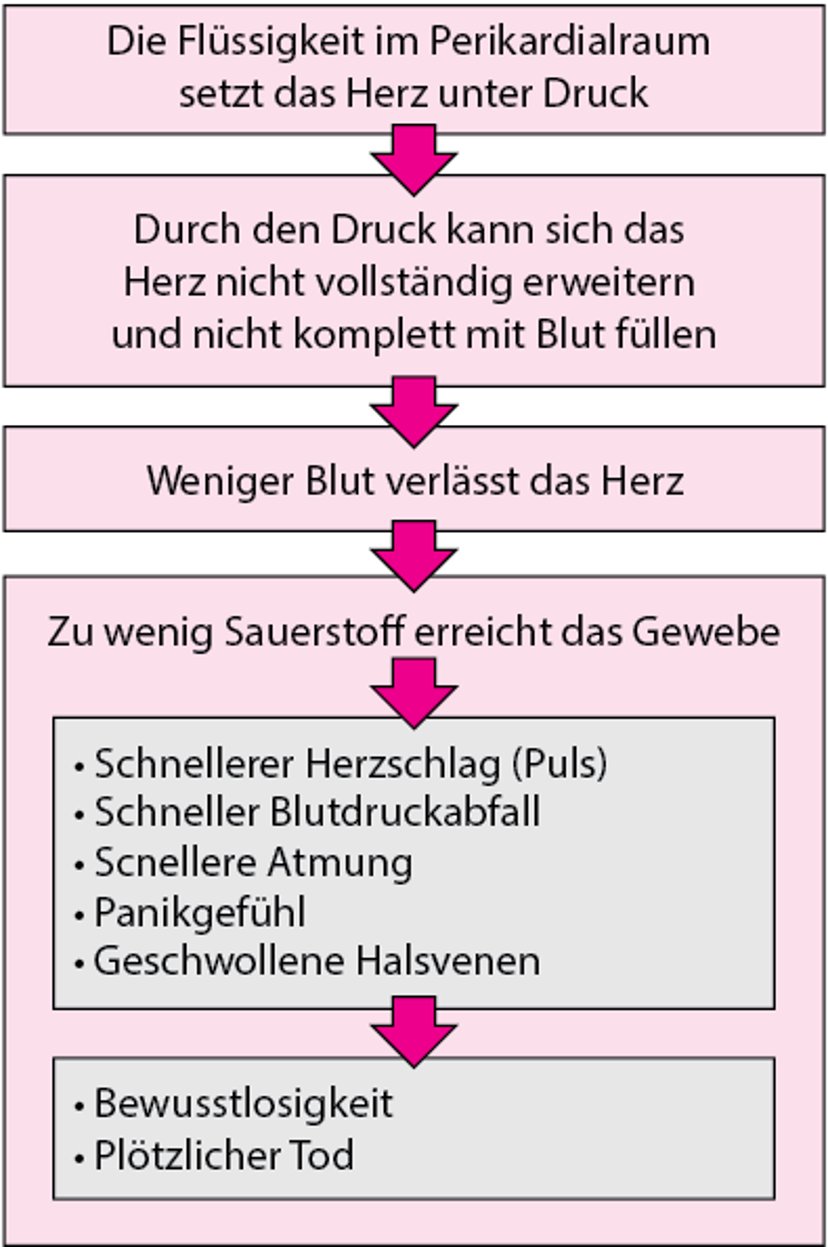 Herzbeuteltamponade