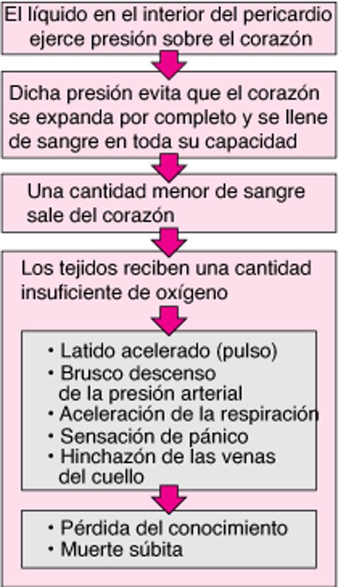 Taponamiento cardíaco