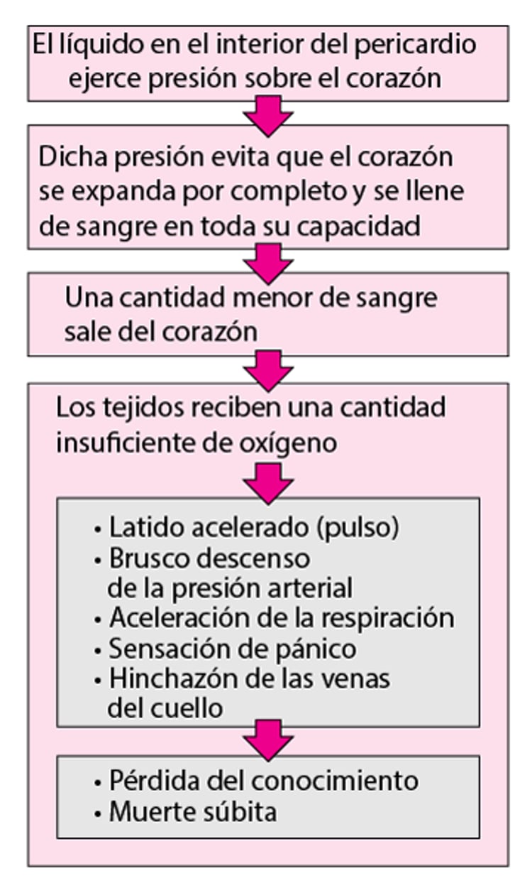 Taponamiento cardíaco