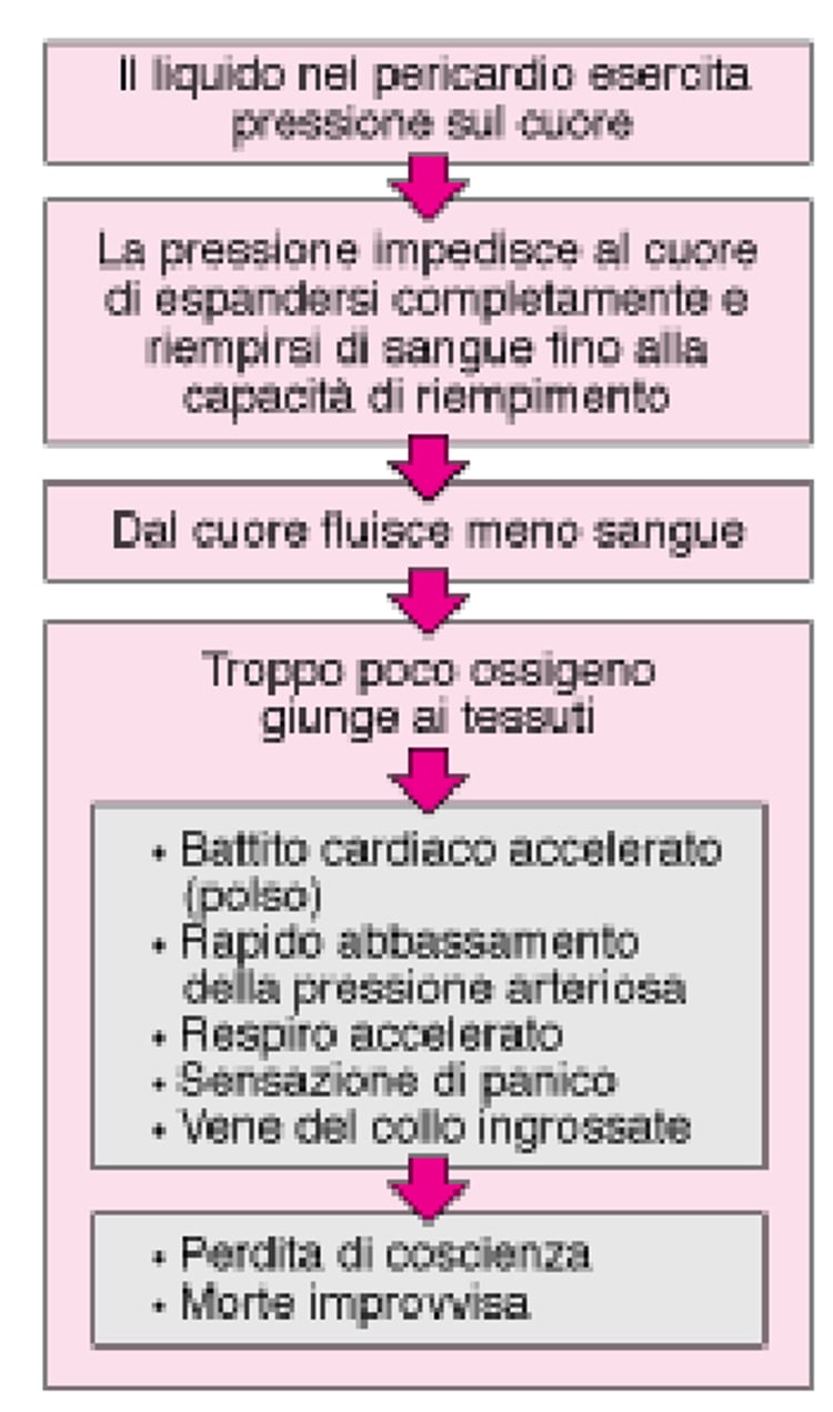 Tamponamento cardiaco
