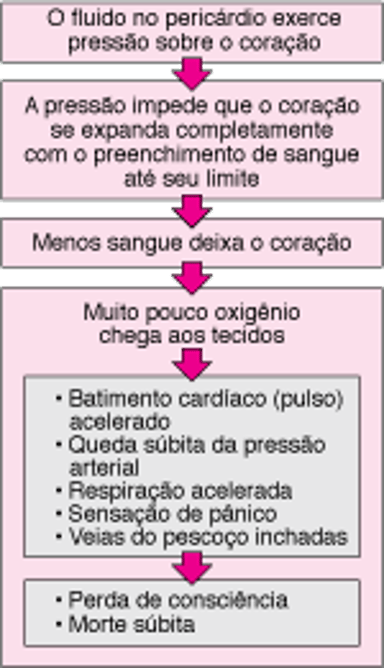 Tamponamento cardíaco