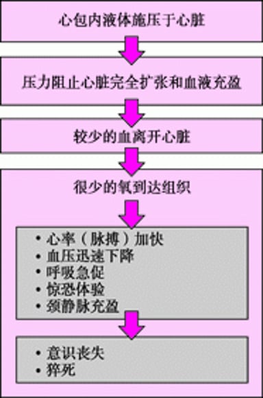心脏压塞