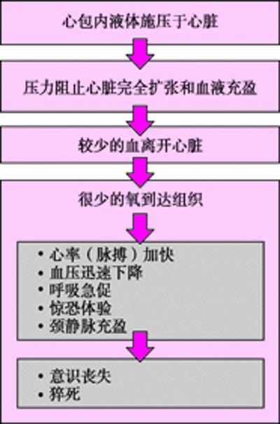 心脏压塞