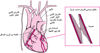 وضعُ طُعم مَجازَة الشريان التاجي Coronary Artery Bypass Grafting