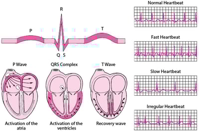 ECG: Reading the Waves