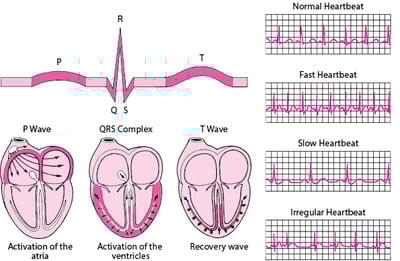 ECG : Lecture des ondes cardiaques